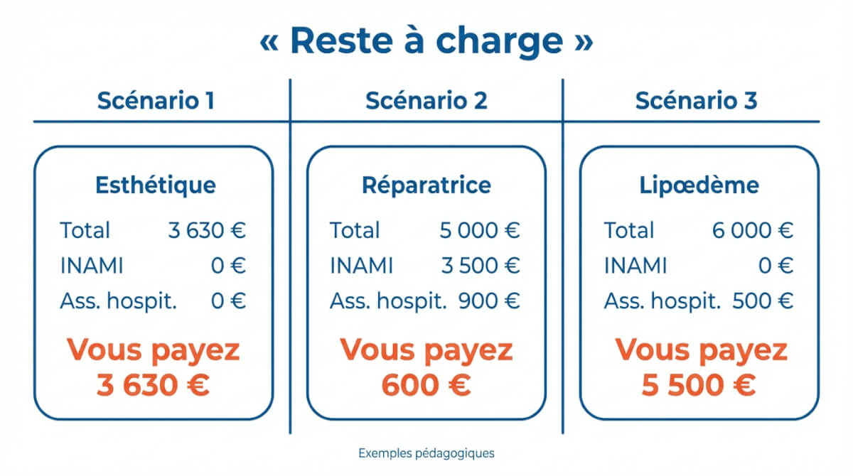 Comparaison de trois scénarios de liposuccion en Belgique montrant total, remboursement INAMI, intervention d'assurance hospitalisation et reste à charge.