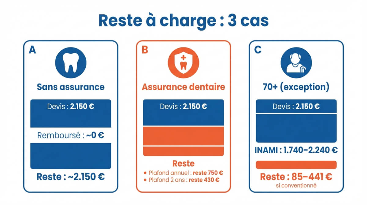 Comparaison du reste à charge sur un devis de 2.150 € selon trois situations : sans assurance, avec assurance dentaire, et exception INAMI à partir de 70 ans.