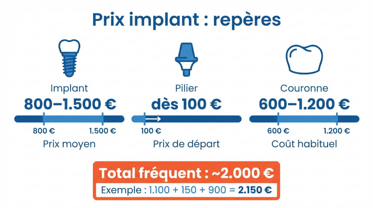 Fourchettes de prix en Belgique pour implant, pilier et couronne, avec total fréquent et exemple chiffré.