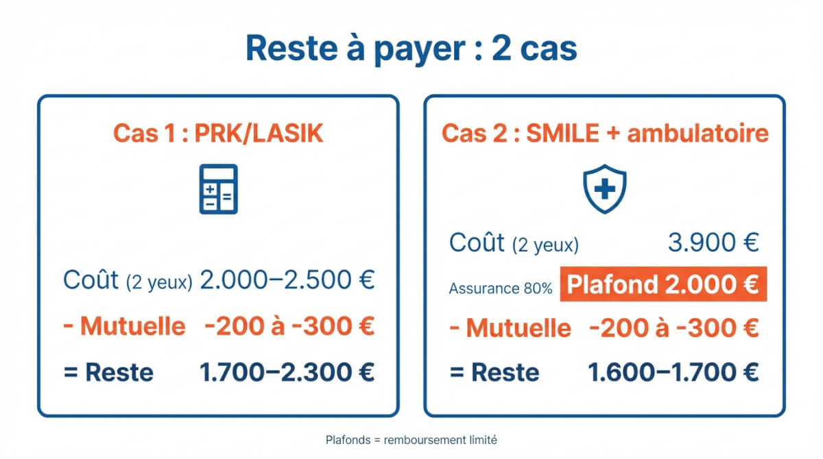 Deux exemples chiffrés du reste à payer après mutuelle et assurance ambulatoire pour PRK/LASIK et SMILE.